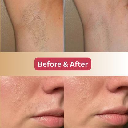 Cyperus Rotundus Root Serum